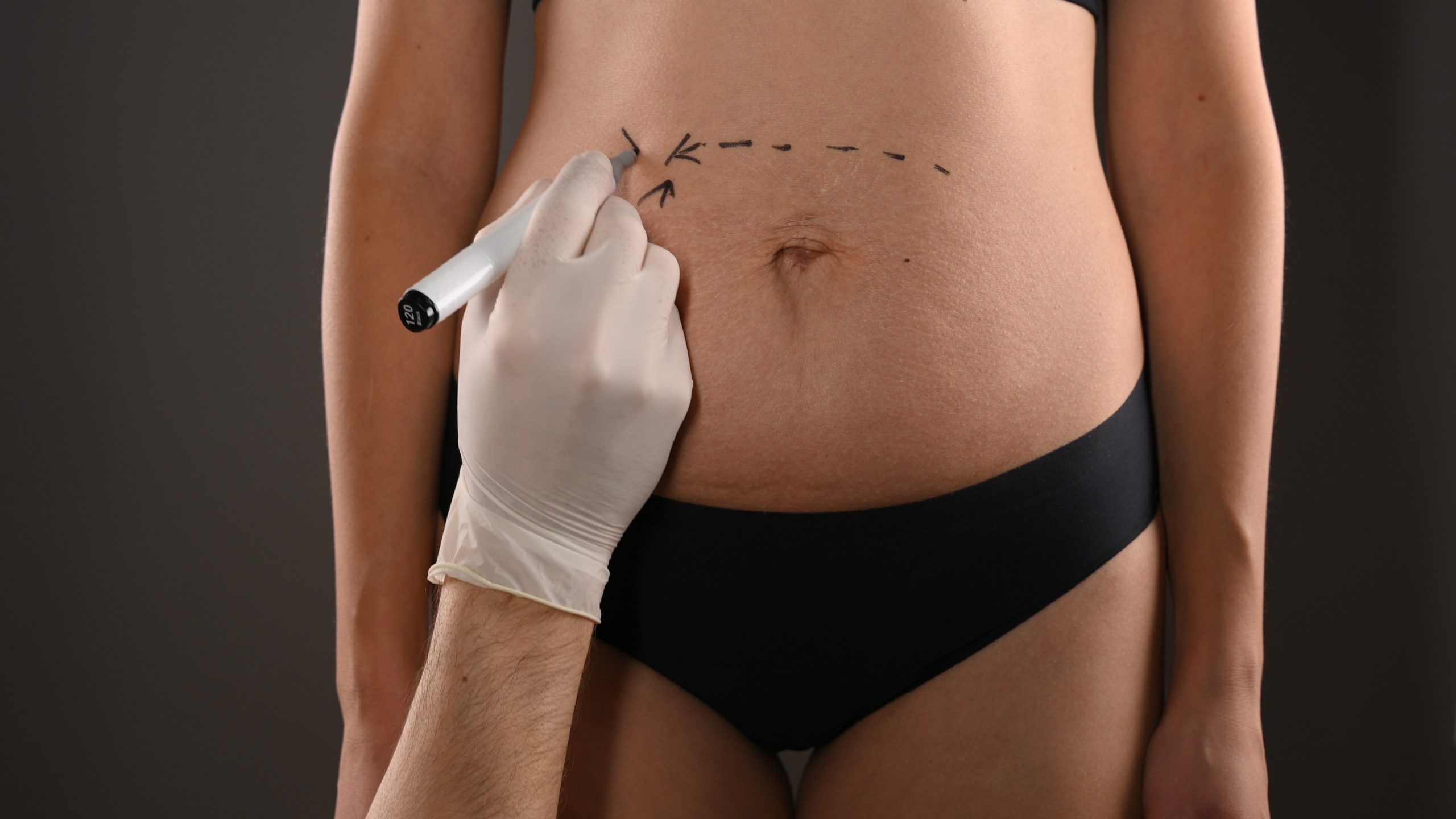 Desvendando as escolhas: cirurgia plástica após a maternidade